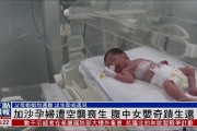 5月大女婴腹中取出罕见寄生胎，医学界震惊